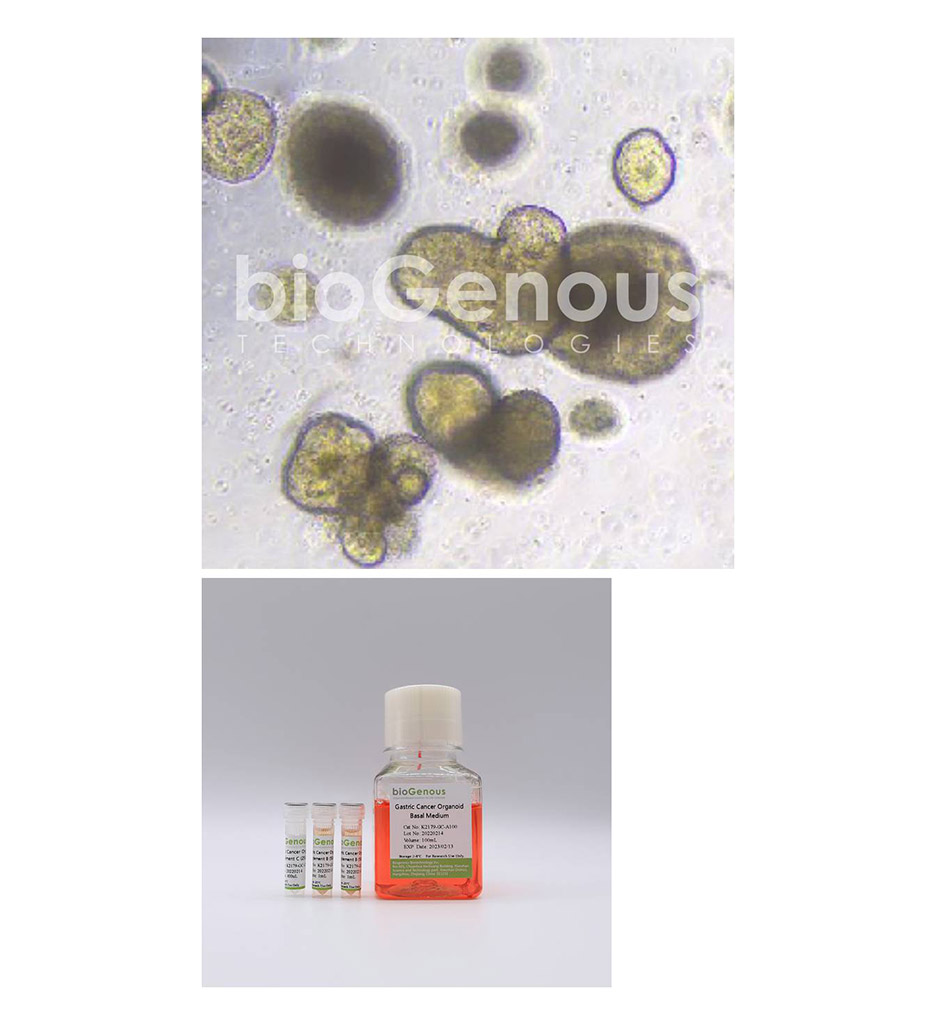 Gastric Cancer Organoid Kit胃癌
