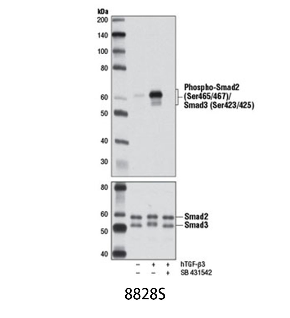 Phospho-Smad2 (Ser465/467)/Smad3 (Ser423/425) (D27F4) Rabbit mAb