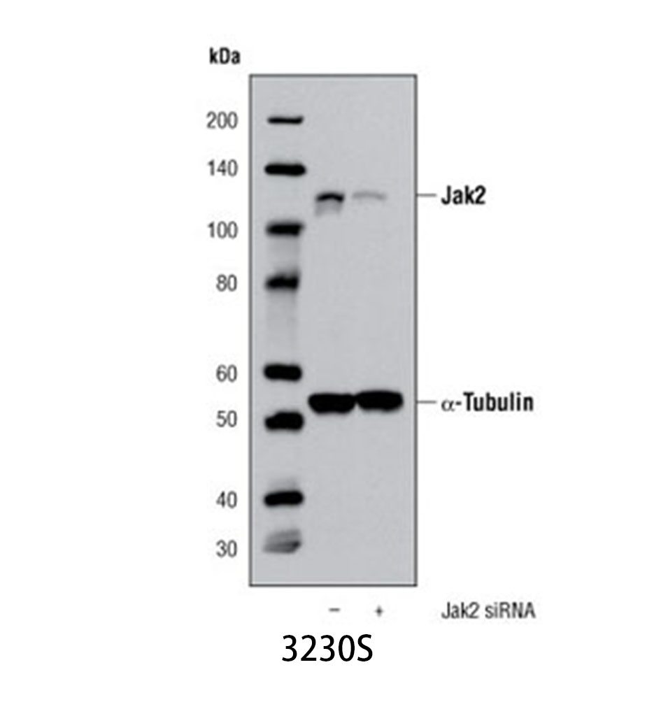 Jak2 (D2E12) XP Rabbit mAb