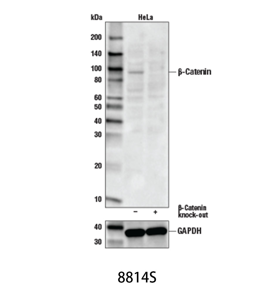 Non-phospho (Active) β-Catenin (Ser33/37/Thr41) (D13A1) Rabbit mAb