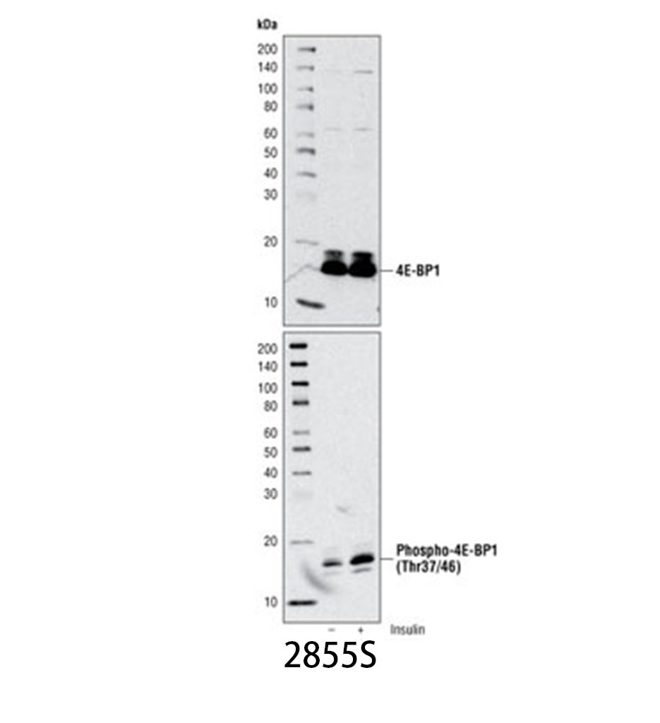 Phospho-4E-BP1 (Thr37/46) (236B4) Rabbit mAb
