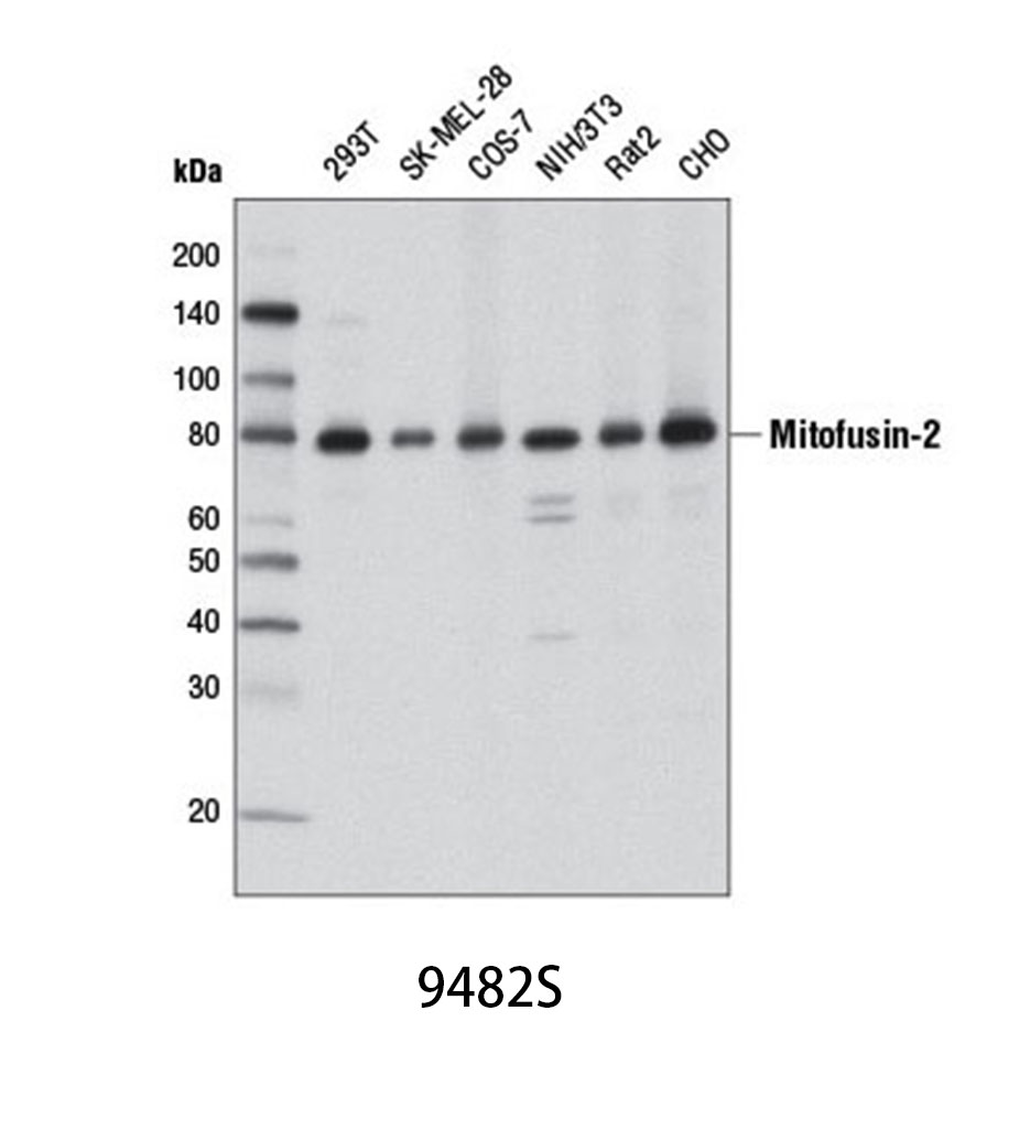 Mitofusin-2 (D2D10) Rabbit mAb