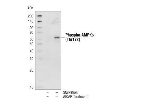 Phospho-AMPKα (Thr172) Antibody