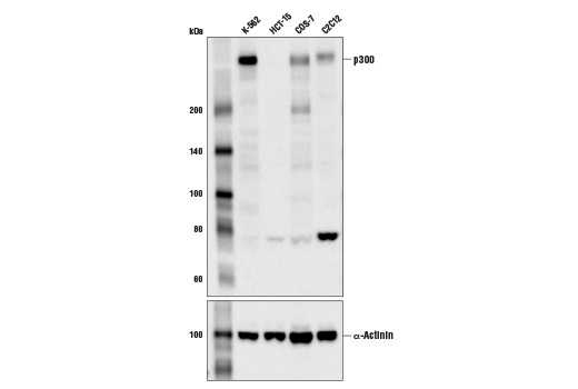 p300 (D8Z4E) Rabbit mAb