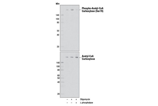 AMPK and ACC Antibody Sampler Kit