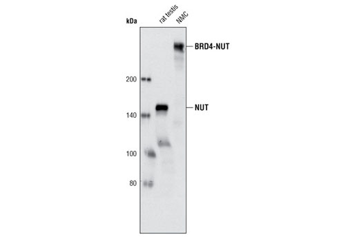 NUT (C52B1) Rabbit mAb