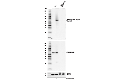 Phospho-SQSTM1/p62 (Ser349) (E7M1A) Rabbit mAb