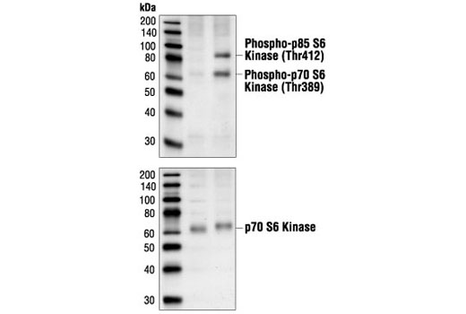 Phospho-p70 S6 Kinase (Thr389) (1A5) Mouse mAb