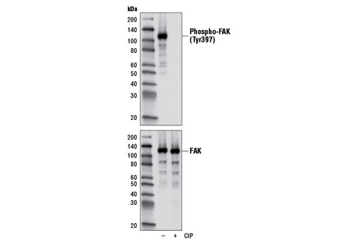 Phospho-FAK (Tyr397) (D20B1) Rabbit mAb
