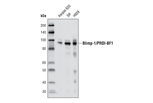 Blimp-1/PRDI-BF1 (C14A4) Rabbit mAb