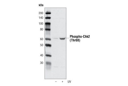 Phospho-Chk2 (Thr68) Antibody