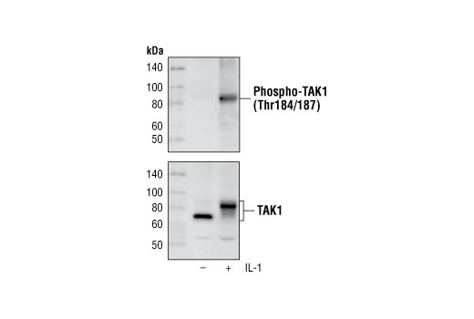 Phospho-TAK1 (Thr184/187) (90C7) Rabbit mAb