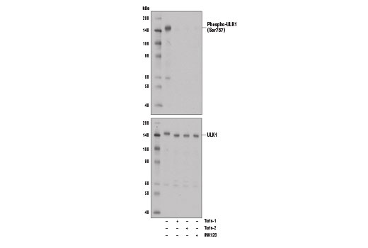 Phospho-ULK1 (Ser757) (D7O6U) Rabbit mAb