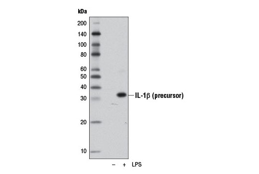 IL-1β (D4T2D) Rabbit mAb (Mouse Specific)