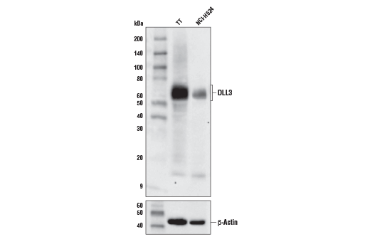 DLL3 (E3J5R) Rabbit mAb
