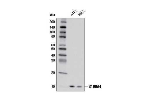 S100A4 (D9F9D) Rabbit mAb