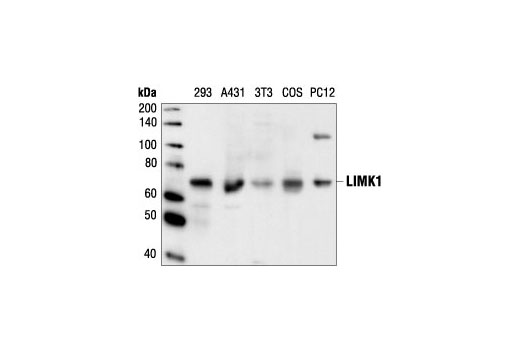 LIMK1 Antibody