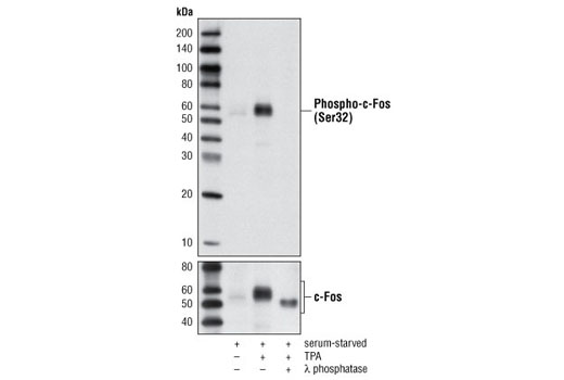 Phospho-c-Fos (Ser32) (D82C12) XP Rabbit mAb