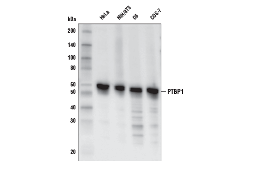 PTBP1 (E4I3Q) Rabbit mAb
