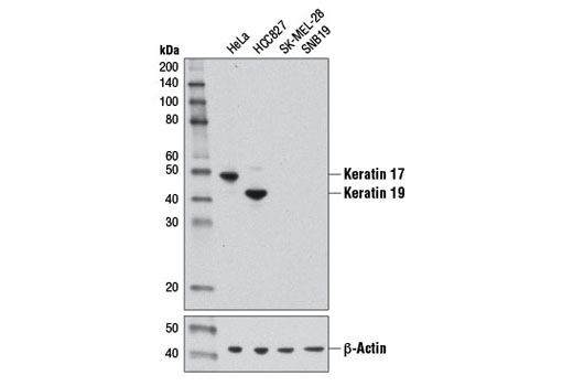 Keratin 17/19 (D4G2) XP Rabbit mAb