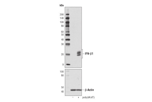 IFN-β1 (D1D7G) Rabbit mAb