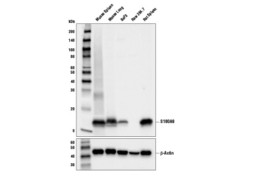 S100A9 (D3U8M) Rabbit mAb (Rodent Specific)