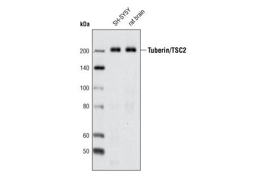 Tuberin/TSC2 (D93F12) XP Rabbit mAb