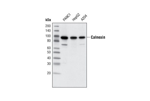 Calnexin (C5C9) Rabbit mAb