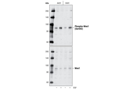 Phospho-Wee1 (Ser642) (D47G5) Rabbit mAb
