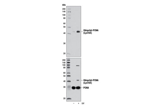 Ubiquityl-PCNA (Lys164) (D5C7P) Rabbit mAb