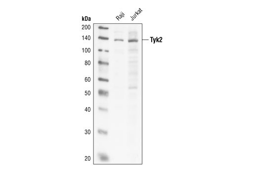 Tyk2 Antibody
