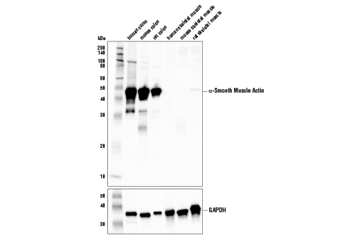 α-Smooth Muscle Actin (1A4) Mouse mAb (IHC Formulated)