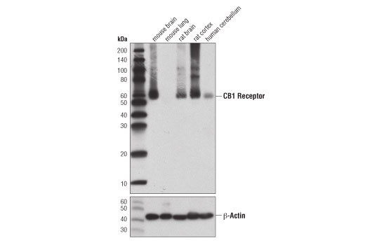 CB1 Receptor (D5N5C) Rabbit mAb