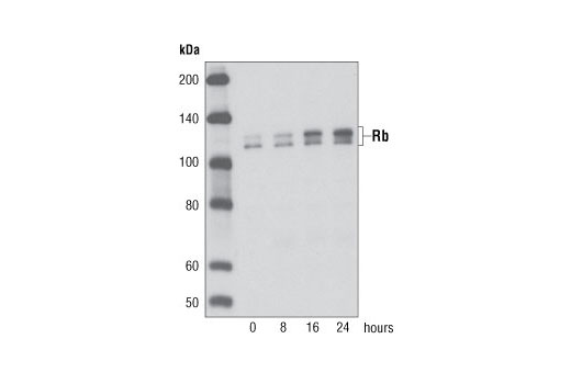 Rb (D20) Rabbit mAb