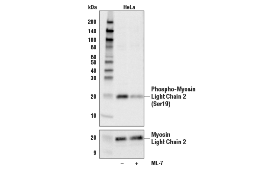 Myosin Light Chain 2 Antibody Sampler Kit