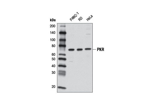 PKR (D7F7) Rabbit mAb