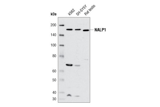 NALP1 Antibody