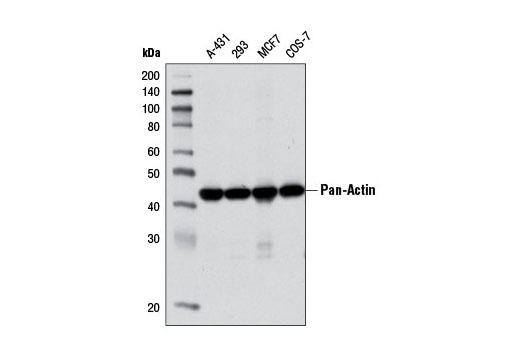 Pan-Actin (D18C11) Rabbit mAb