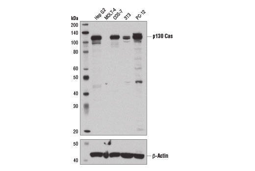 p130 Cas (E1L9H) Rabbit mAb