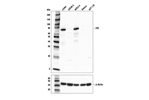 ITK (E4X7M) Rabbit mAb