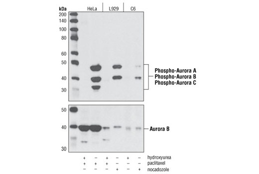 Phospho-Aurora A (Thr288)/Aurora B (Thr232)/Aurora C (Thr198) (D13A11) XP Rabbit mAb