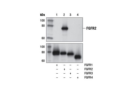 FGF Receptor 2 (D4H9) Rabbit mAb