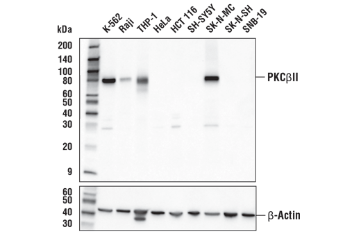 PKCβII (D9S2U) Rabbit mAb