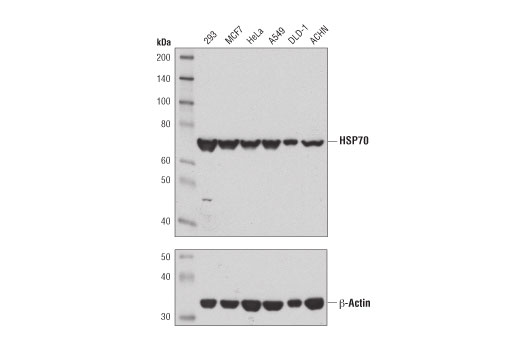 HSP70 (D1M6J) Mouse mAb
