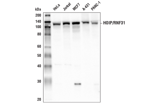 HOIP/RNF31 (E6M5B) Rabbit mAb