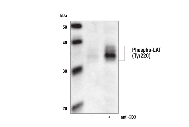 Phospho-LAT (Tyr191) Antibody