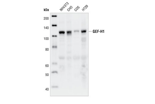 GEF-H1 (55B6) Rabbit mAb