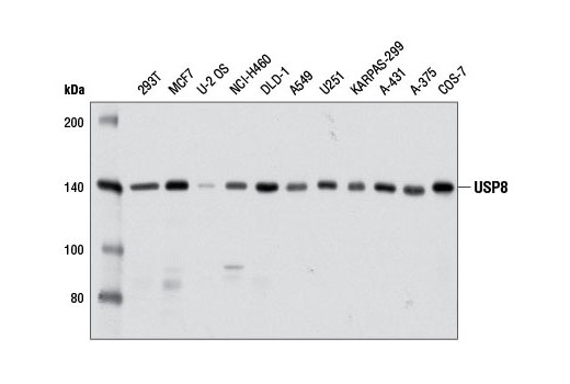 USP8 (D18F6) Rabbit mAb
