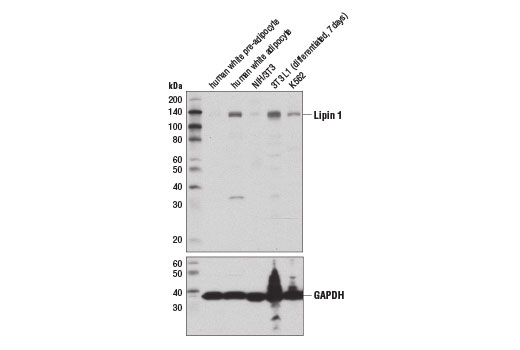 Lipin 1 (D2W9G) Rabbit mAb