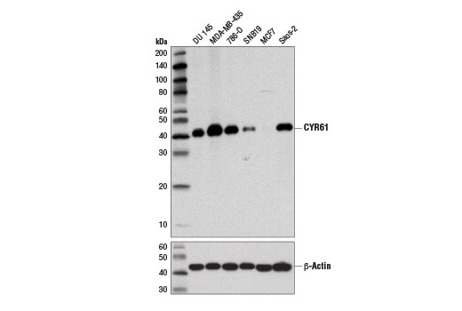 CYR61 (D4H5D) XP Rabbit mAb